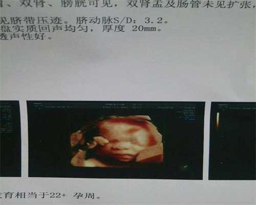 广州试管代生_广州医院可以供卵做试管婴儿吗_甲状腺癌